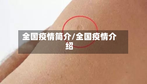 全国疫情简介/全国疫情介绍-第3张图片